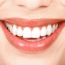 прекаленото количество флуор прави зъбите чупливи