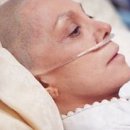 пет симптоми, които показват начален стадий на рак