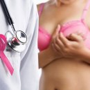 рак на гърдата: осем неща, които можете да направите, за да го предотвратите