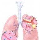 ето как да изчистите белите дробове за 3 дни
