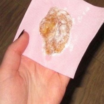 почти всяка жена го има, но ето как да го разпознаете …