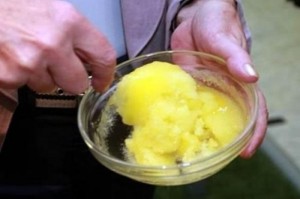 как да отстраним зъбния камък в домашни условия