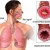 ако имате астма, направете следната важна процедура, за да можете да дишате добре