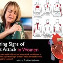 инфаркт-скрити симптоми, специално при жените
