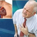 как да разпознаете симптомите на инфаркта