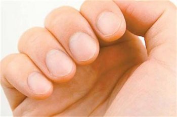 по ноктите на ръцете можете да разпознаете някои болести