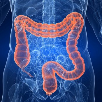 симптоми и локализация на рак на дебелото черво