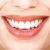 домашно избелване на зъби-