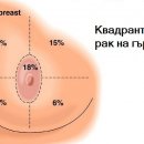 Опасни ли са бучки, обрив на зърната, набръчкана кожа на гърдите