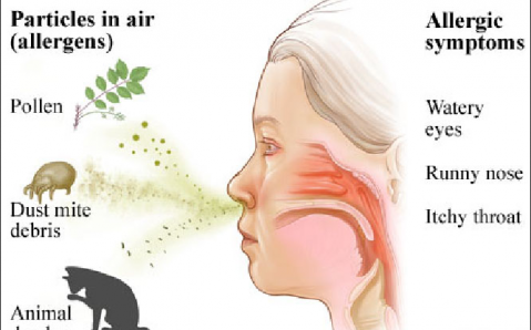 алергична кашлица  симптоми и лечение