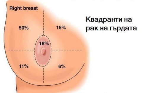 опасни ли са бучки, обрив на зърната, набръчкана кожа на гърдите