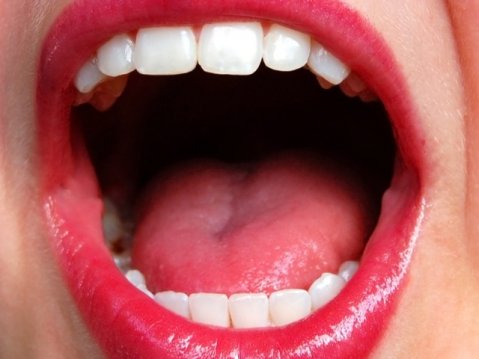 мас, сода и невен срещу млечница -гъбички по езика-