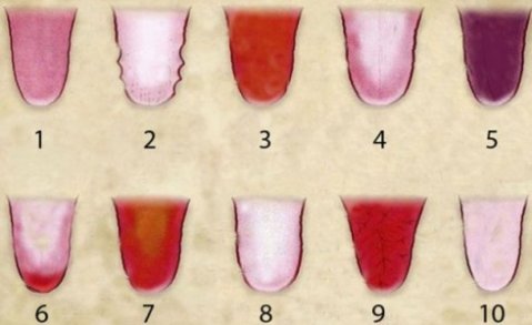 както на медицински картон върху езика е изписано здравословното ни състояние