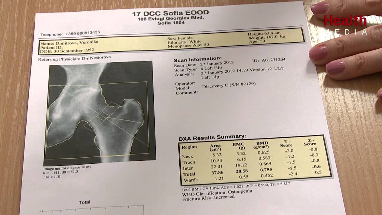 модерно изследване за остеопороза